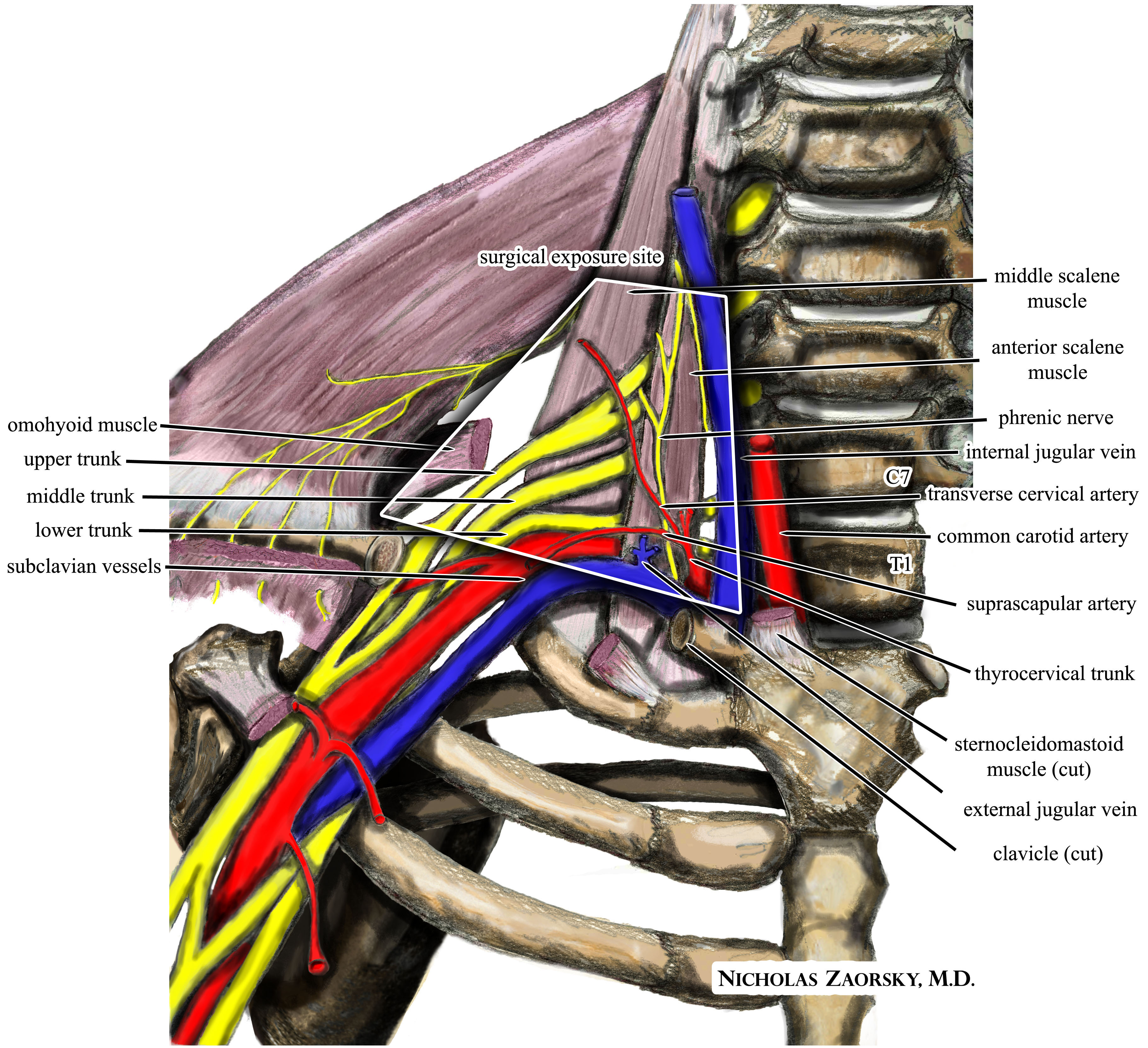 Thoracic outletinlet-Syndrom